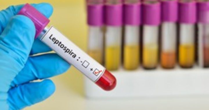 Що таке лептоспіроз ?