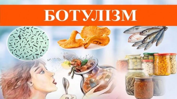 Ботулізм – шляхи зараження, клінічні прояви та профілактика